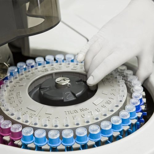 lab centrifuge maintenance lab centrifuge maintenance